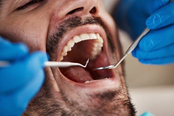 Best Emergency Tooth Extraction in Mangonia Park, FL